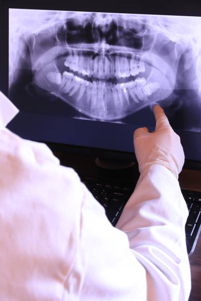 Best Broken or Chipped Tooth Repair in West Fairview, PA