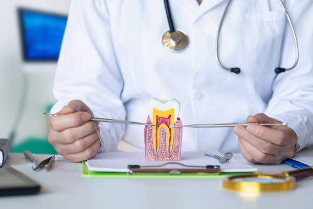 Best Knocked-Out Tooth (Avulsed Tooth) Treatment in West Fairview, PA
